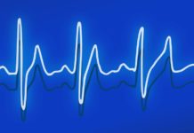 ¿Qué especialista trata la disautonomía? Especialistas que tratan disautonomía