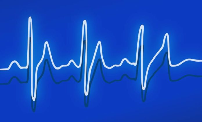 Especialistas que tratan disautonomía