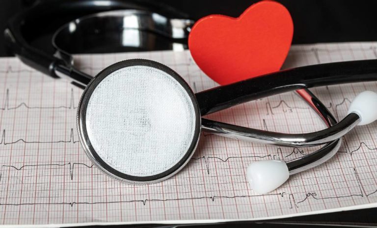 Taquicardia Sinusal Inapropiada